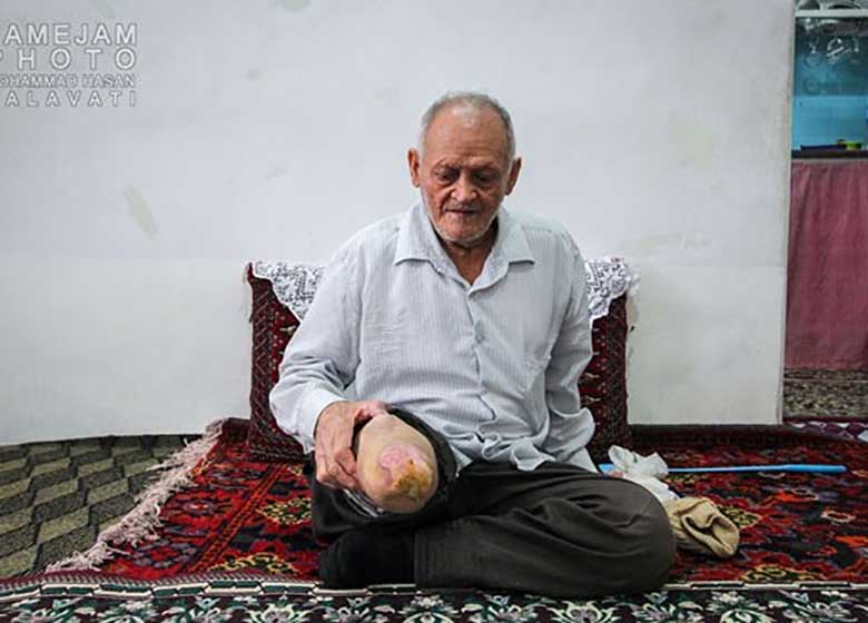 گزارشی تکاندهنده از شهرک جذامیهای مشهد