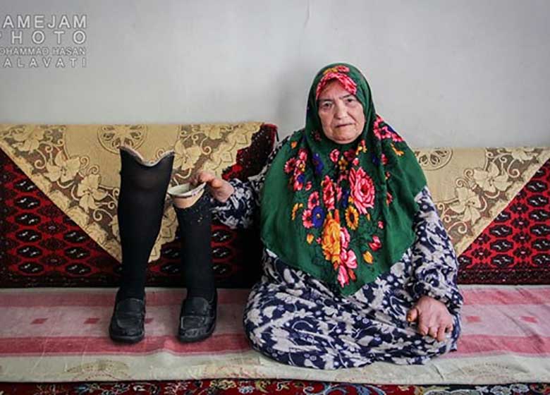 گزارشی تکاندهنده از شهرک جذامیهای مشهد