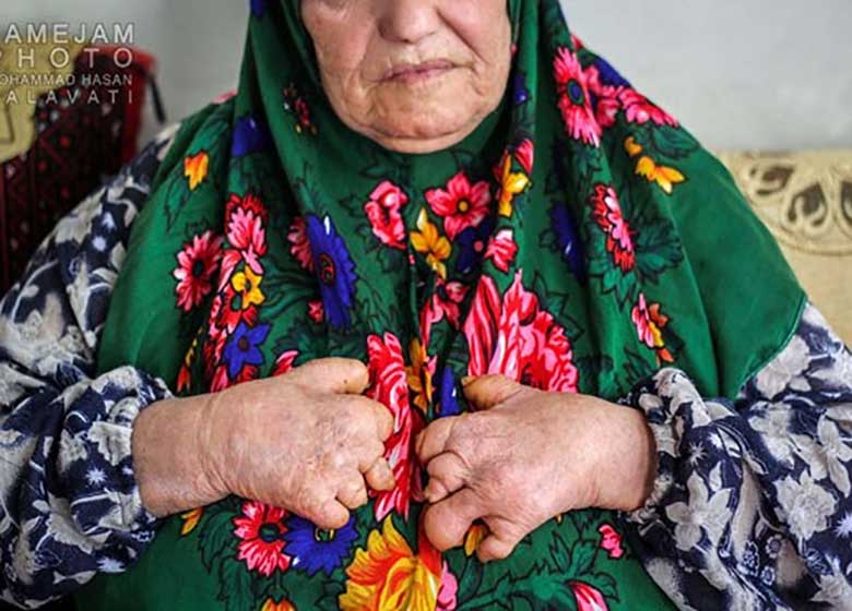 گزارشی تکاندهنده از شهرک جذامیهای مشهد