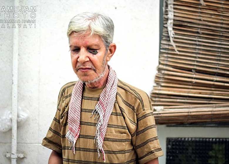 گزارشی تکاندهنده از شهرک جذامیهای مشهد