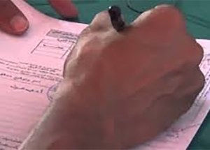 76