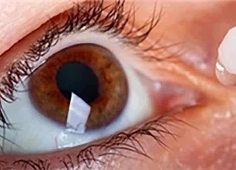 شایعترین مشکل چشمی