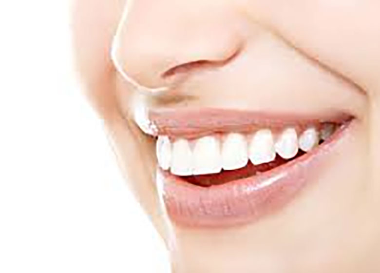 آنچه که باید درباره سفید کردن دندانها بدانید