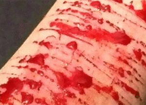 42
