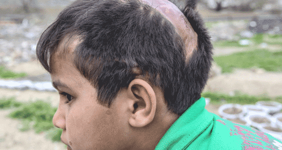 وضعیت تاسف بار حاشیهنشینان «شهران»