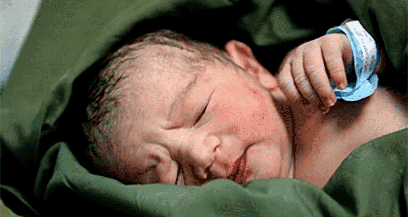 نوزادی عجیب که رودهاش خارج از شکمش است/عکس