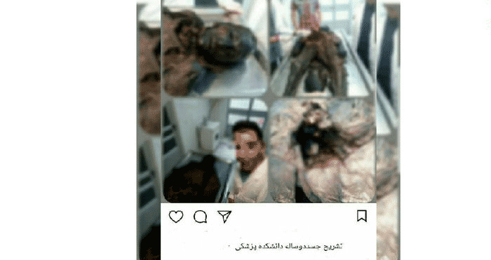 سلفی زننده پسر دانشجو با یک جسد!/عکس