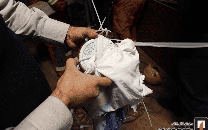 عکسبرداری از بیمار در اتاق "MRI" حادثهساز شد + تصاویر
