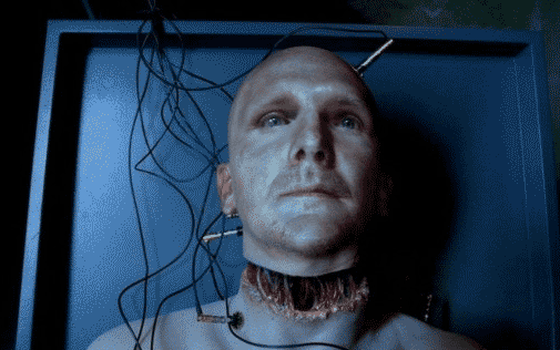 آیا عمل پیوند سر انسان حقیقت دارد؟