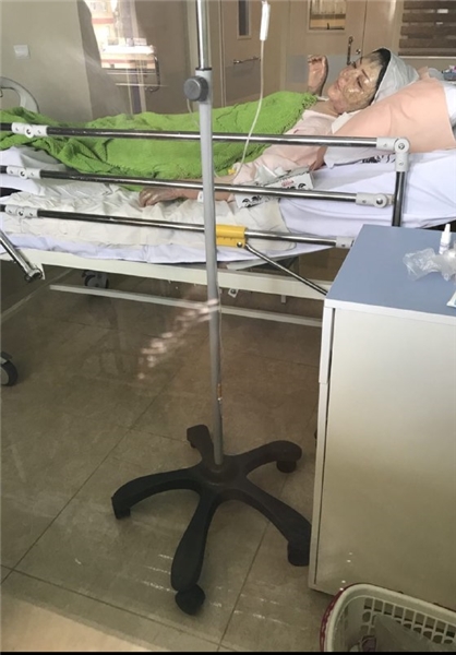 دومین اسید پاشی در تبریز /مریم در اسید سوخت+تصاویر