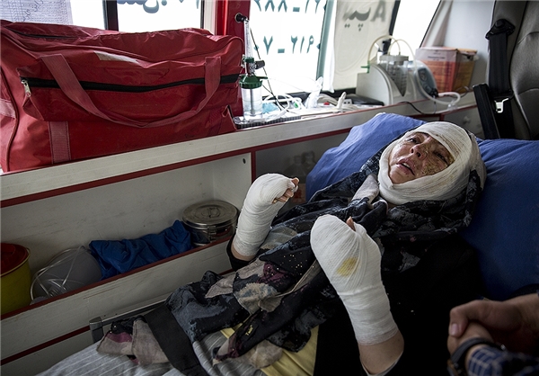 دومین اسید پاشی در تبریز /مریم در اسید سوخت+تصاویر