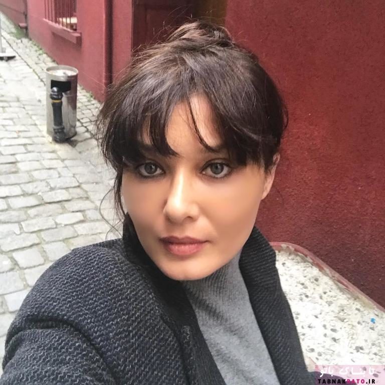 بازیگر زن معروف، پشیمان از عمل زیبایی/عکس