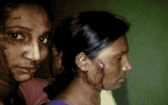 حمله پلنگ به یک دختر جوان + عکس