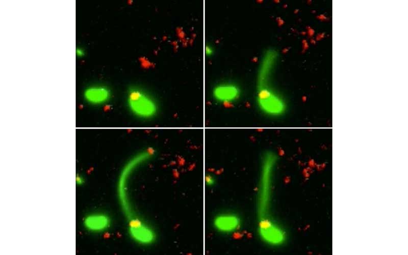 شکار تصاویر باکتری های مهاجم به «دی ان ای» انسان