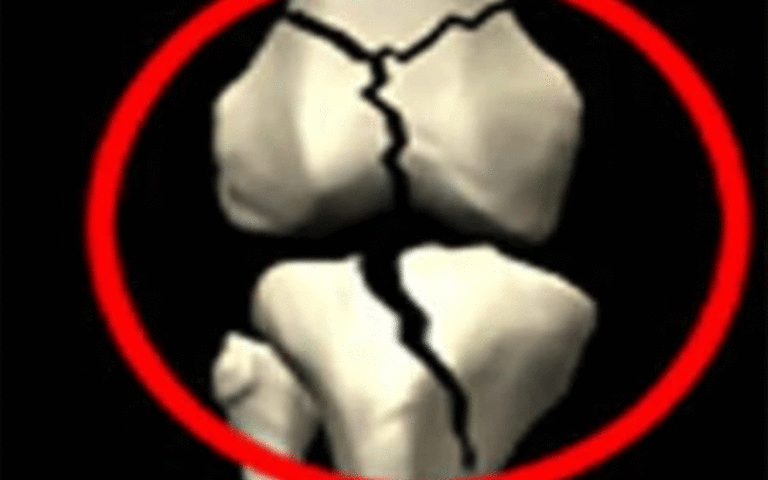 40