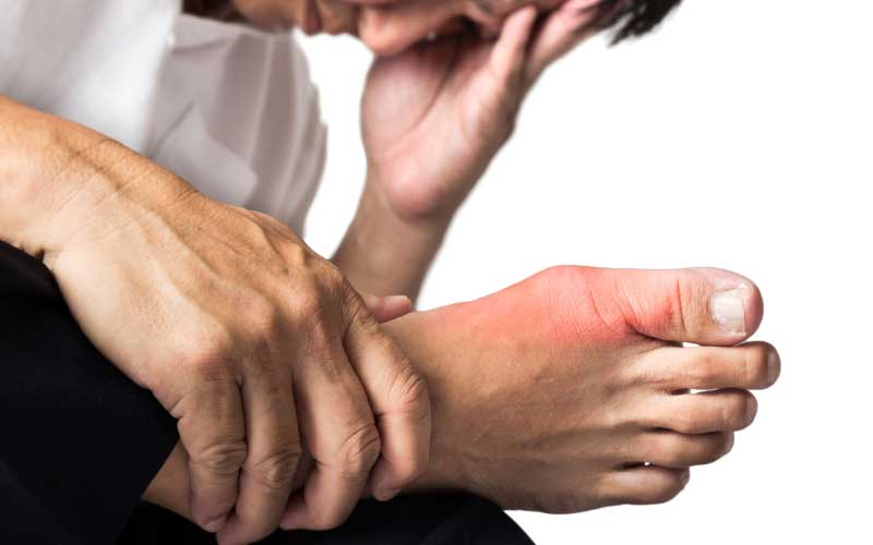چگونه اسید اوریک خونمان را پایین بیاوریم؟