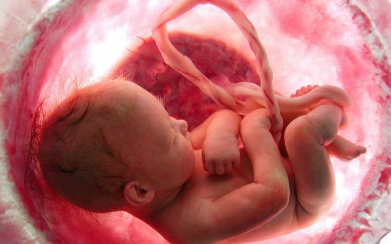 24