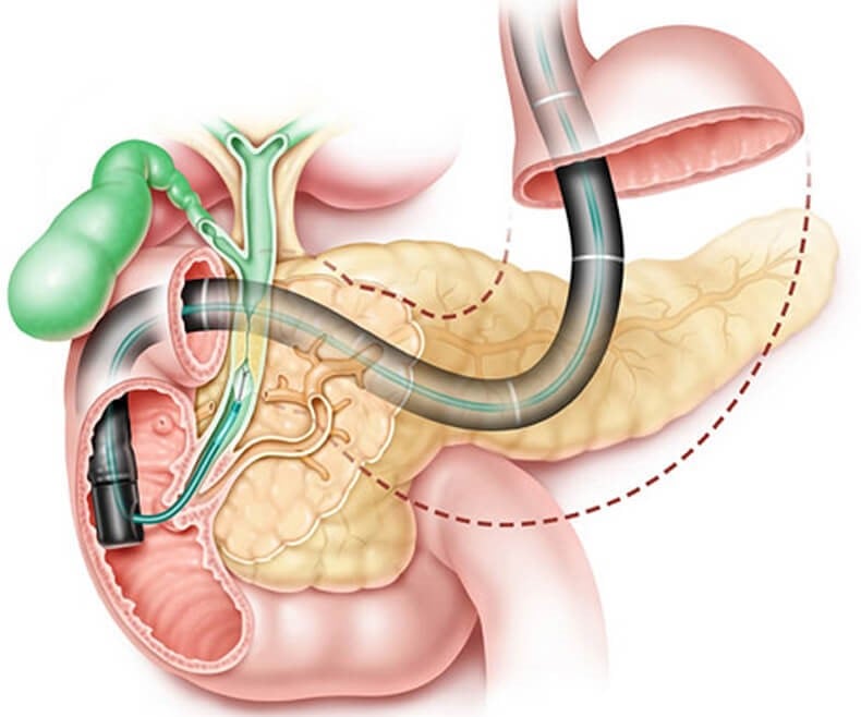 تلخی دهان از چیست