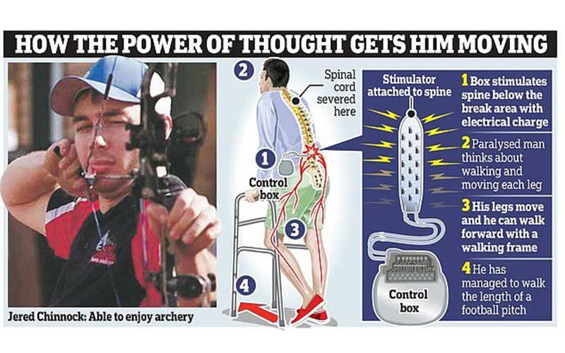 ۳ معلول حرکتی با کاشت الکترودی در مغز دوباره راه رفتند