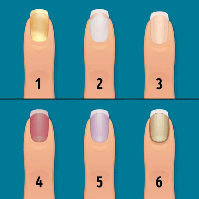 هر آنچه ناخن ها درباره سلامتی بدن می گویند