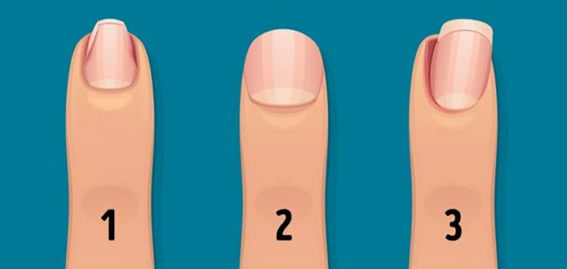 هر آنچه ناخن ها درباره سلامتی بدن می گویند