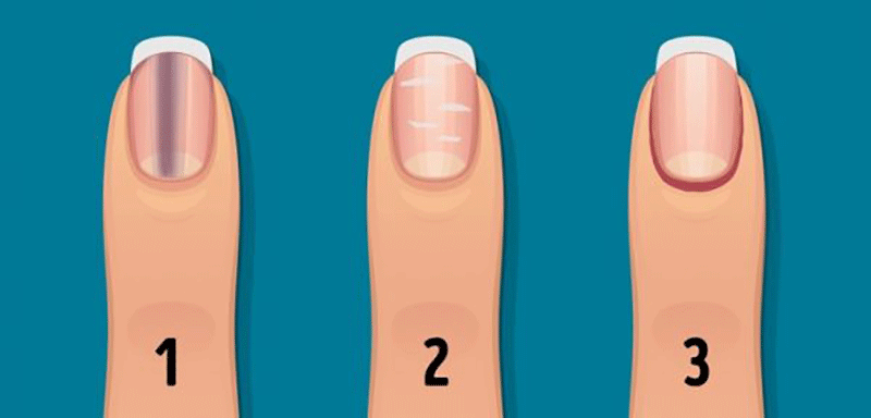 هر آنچه ناخن ها درباره سلامتی بدن می گویند