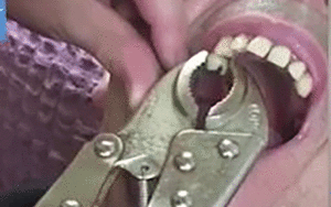 25