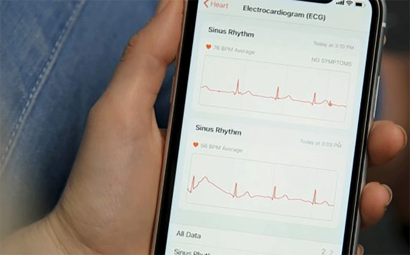 ساعت اپل به روزرسانی شد / شناسایی سریع بیماریهای قلبی