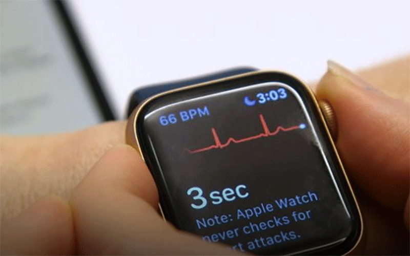 ساعت اپل به روزرسانی شد / شناسایی سریع بیماریهای قلبی