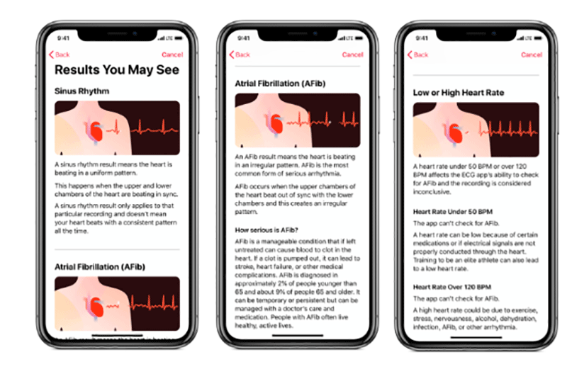 ساعت اپل به روزرسانی شد / شناسایی سریع بیماریهای قلبی