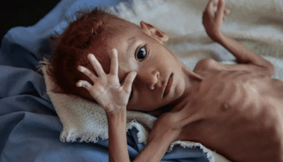 سازمان‌ملل: یمن در آستانه فاجعه عظیمی قرار دارد
