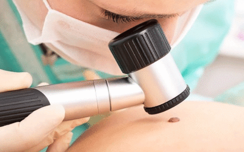 بیماران سرطانی در معرض ابتلا به مشکلات پوستی