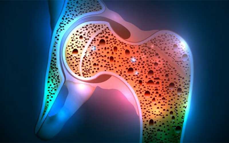 تولید استخوان نیمهزنده برای درمان ضایعات استخوانی