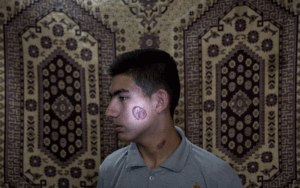درمان سالک