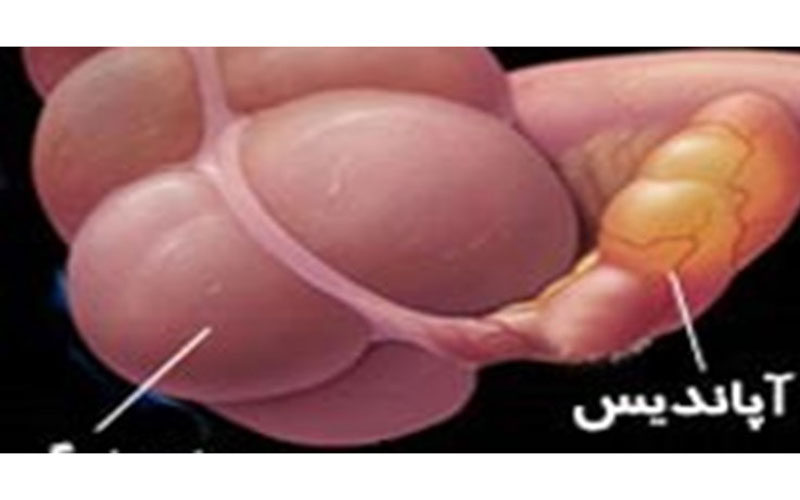 «آپاندیس»-چه-علائمی-دارد؟