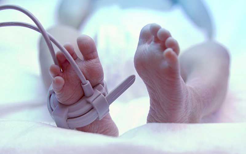 ارتباط مصرف نوعی داروی HIV با میکروسفالی