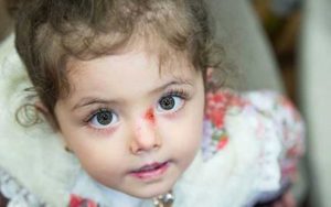 اما-و-اگرهای-کمبود-پانسمان-بیماران-پروانه‌ای