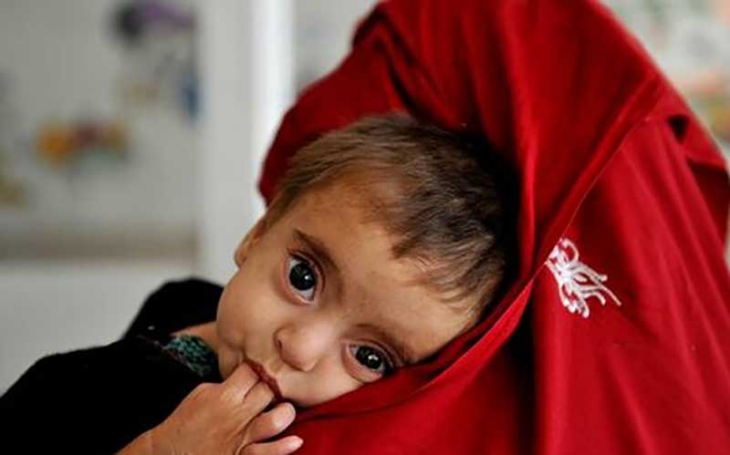 توزیع بسته‌های غذایی بین زنان باردار مناطق محروم