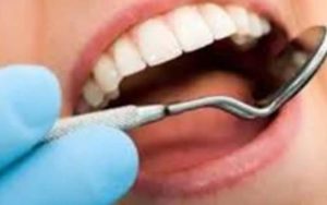 سلامت دندان را با اعمال زیبایی به خطر نیندازید