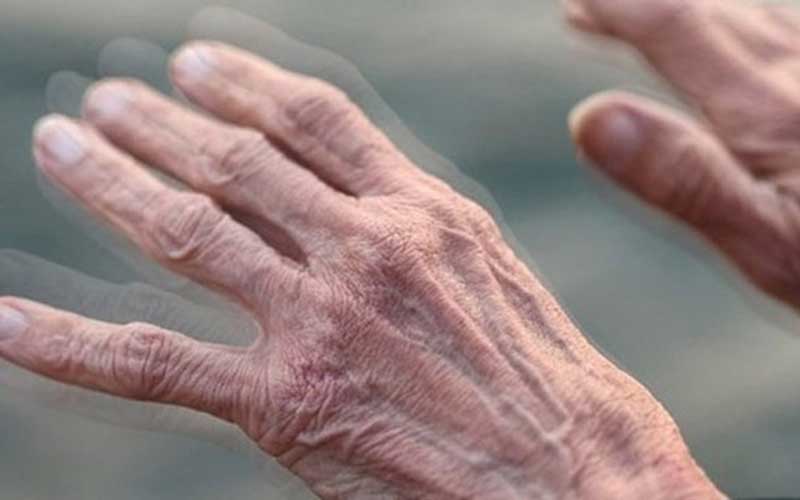 مهمترین علت ابتلا به «پارکینسون» چیست؟