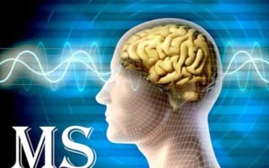 سلول‌های-بنیادی،-کلید-درمان-بیماری-MS