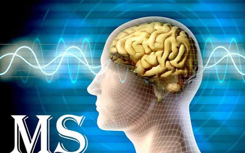 سلول‌های-بنیادی،-کلید-درمان-بیماری-MS