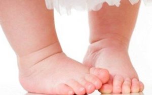 «پای-پرانتزی»-نوزادان-در-چه-سنی-قابل-تشخیص-است؟