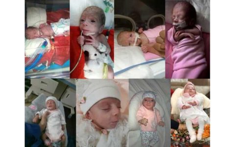 ماجرای تولد نوزاد نیم کیلویی در قم 1 ماجرای تولد نوزاد نیم کیلویی در قم