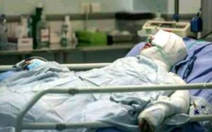احتمال-ابتلا-به-کرونا-در-افراد-دچار-سوختگی-بیشتر-است