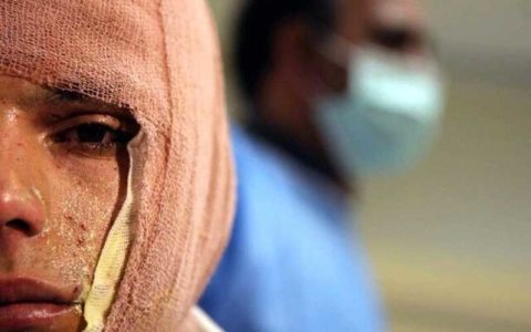 انفجار مواد محترقه سه نوجوان را راهی بیمارستان کرد 1 انفجار مواد محترقه سه نوجوان را راهی بیمارستان کرد