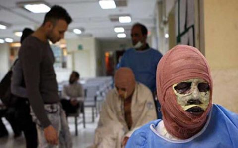تعداد مصدومان حوادث چهارشنبه آخر سال به ۷۵۱ تن رسید 1 تعداد مصدومان حوادث چهارشنبه آخر سال به ۷۵۱ تن رسید