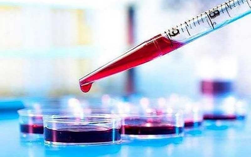 تشخیص-آلزایمر-با-وجود-میزان-مس-در-خون