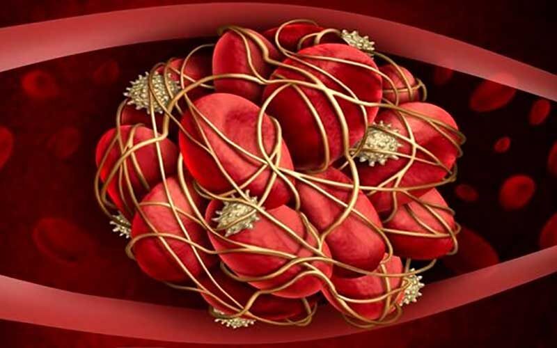 لخته‌-خون؛-از-علائم-تا-عوارض