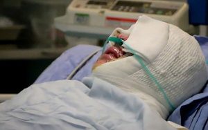 تجاوز-به-پسر-جوان-انگیزه-انتقام-با-اسیدبود
